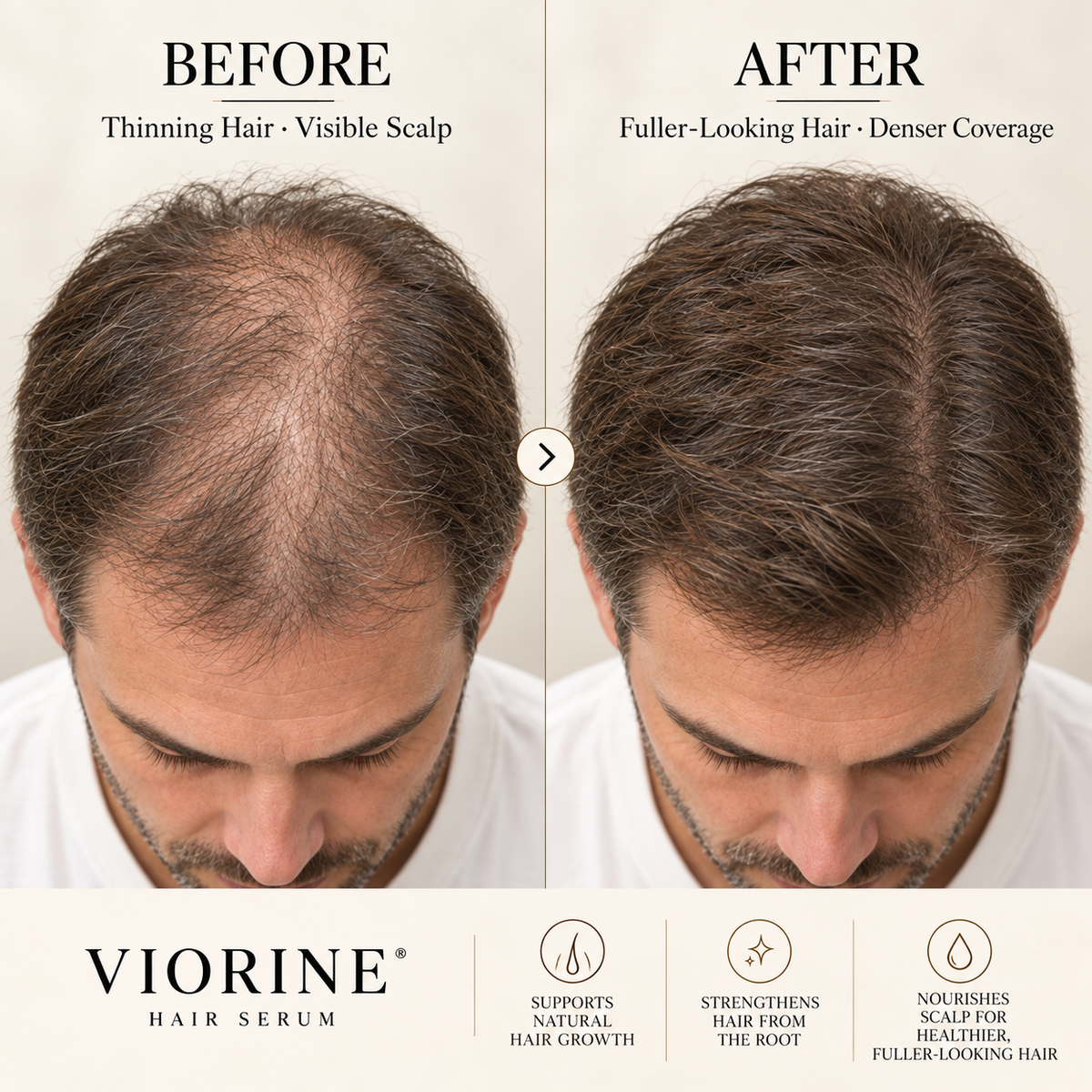 VIORINE fuller-looking hair comparison visual